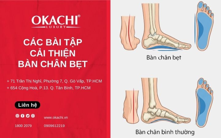 Vì sao bài tập chữa bàn chân bẹt lại quan trọng hơn đế lót hay giày chuyên biệt?