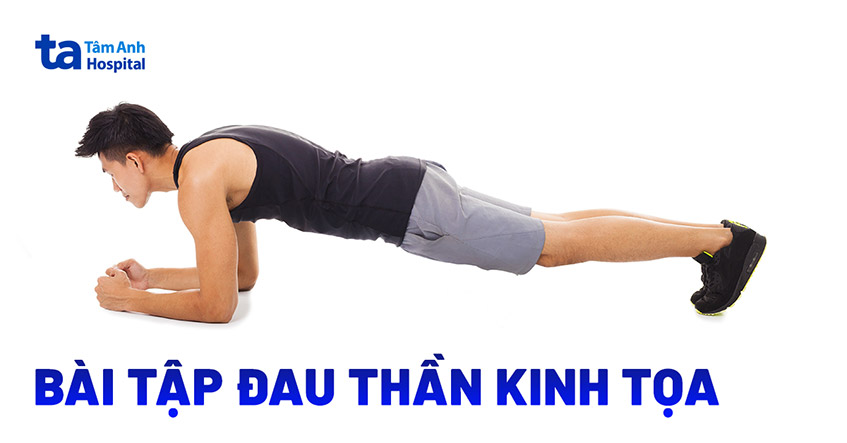 Đau thần kinh tọa không phải “đau lưng thông thường” — hiểu đúng để tập đúng