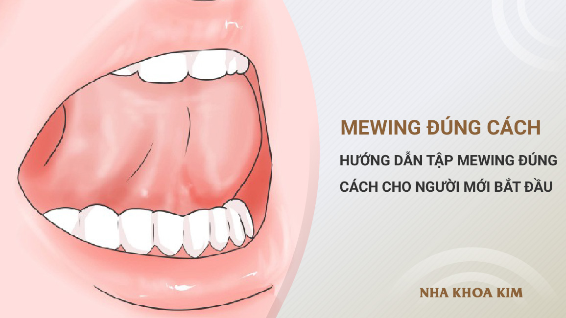 Mewing là gì? Không phải “đẩy lưỡi lên”, mà là “đặt lại vị trí sinh lý”