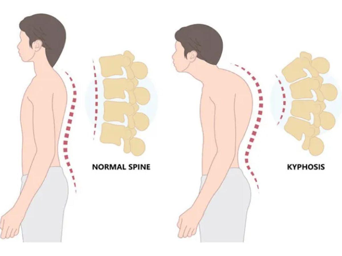 Tại sao bạn cần tập vai sau & lưng trên — ngay cả khi không muốn “có vai to”