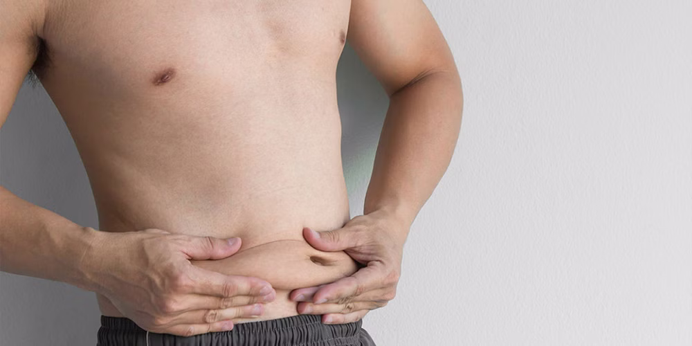 Làm sao để biết chắc mình bị skinny fat — 5 dấu hiệu khách quan