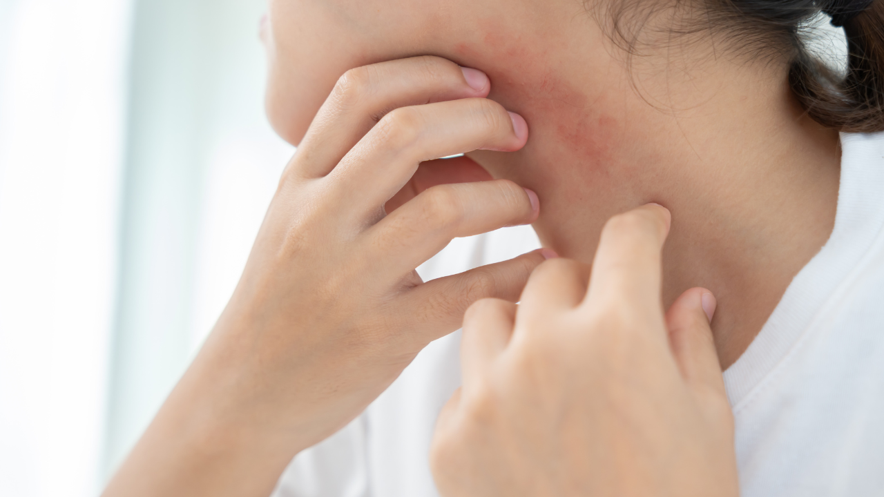 Collagen có tác dụng gì cho da — và tại sao 80% người dùng thất bại