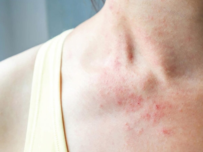 Đối tượng nào thực sự nên dùng trà giảm mỡ bụng — và ai cần tránh
