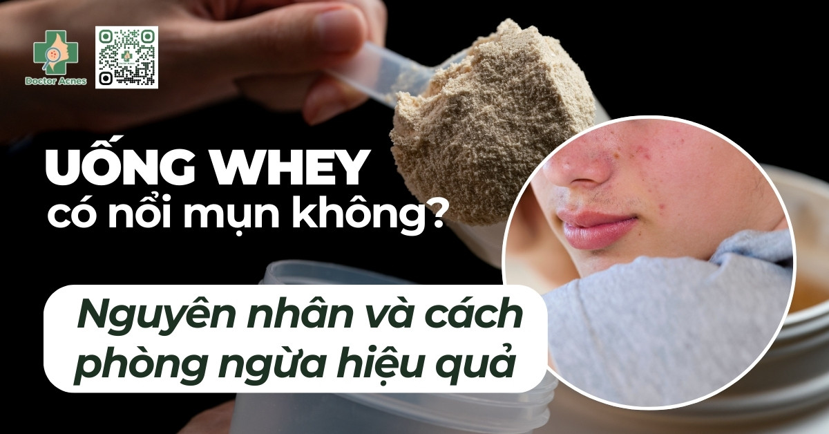 Whey protein là gì? Không phải “bột tăng cơ thần thánh”, mà là một protein sữa được tinh chế